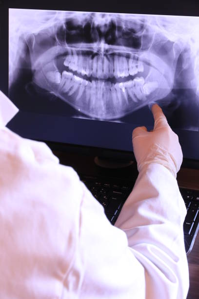 Best Emergency Dental Care for Broken or Chipped Teeth in Lafayette, TN